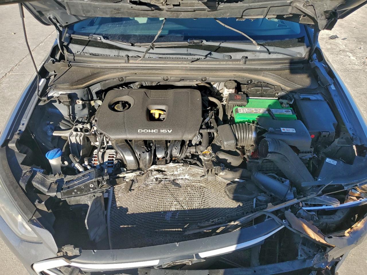 Hyundai ELANTRA Se Image 11